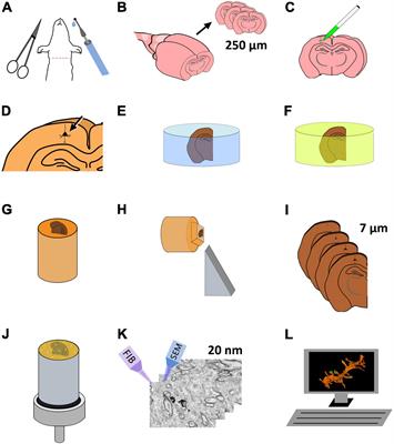 Single-Neuron Labeling in Fixed Tissue and Targeted Volume Electron Microscopy